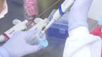 Centro de pesquisa do Hospital de Base estuda nova vacina contra covid-19