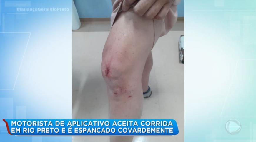 Motorista de aplicativo aceita corrida em Rio Preto e é espancado covardemente