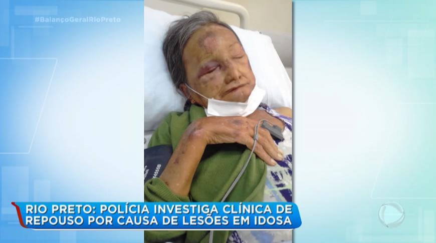 Polícia investiga Clínica de Repouso de Rio Preto por causa de lesàµes em idosa