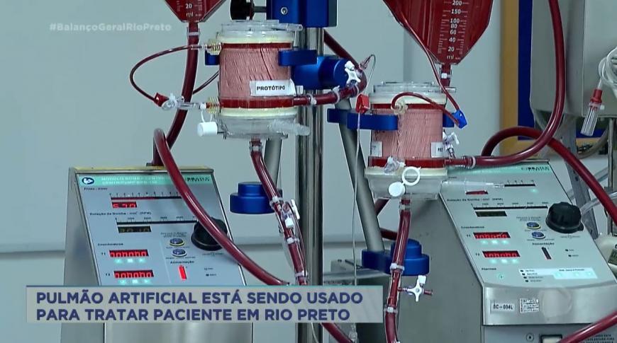 Pulmão artificial está sendo usado para tratar paciente