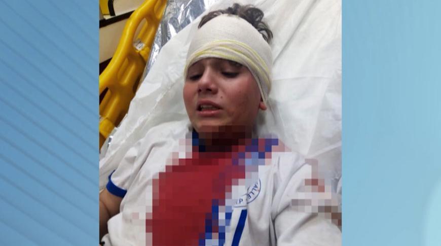 Adolescente é atacado por pit bull em Rio Preto